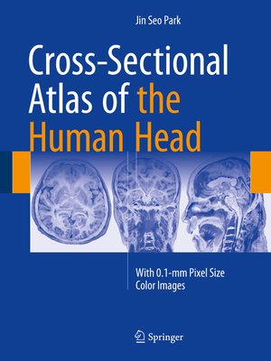 cover image of Cross-Sectional Atlas of the Human Head